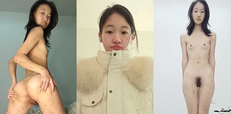 山东临沂电子科技学院风骚学妹 张雯娟 约炮成瘾脚踏多船 身染性病 全身溃烂 还自慰扣穴！
热搜 HOT-51吃瓜网