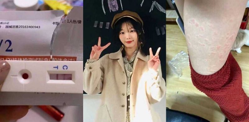 百度贴吧艾滋病论坛 清纯美少女自曝 在电影院洗手间 与陌生叔叔无套做不幸中招 腿部出现大量红点！-51吃瓜网