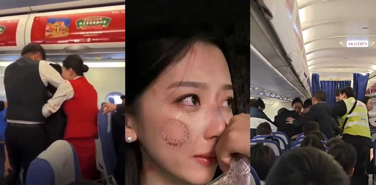 太离谱！两女子飞机上互嫌味道刺鼻打架 深航空姐劝架被咬伤 咬人现场视频流出 脸上咬痕触目惊心！ - 51吃瓜网-51吃瓜网