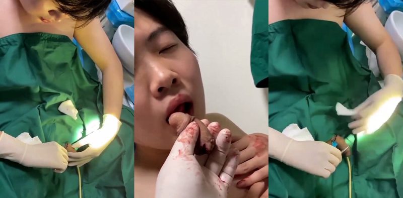 猎奇重口慎入 人妖变性自己动手切掉JJ 切除后对着自己的二弟口交做最后的告别 这TM真够变态啊！-51吃瓜网