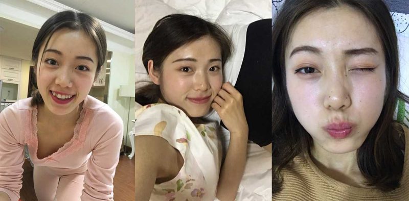 湖南 韩亚超 情侣私拍泄密 出轨怀孕奉子成婚 口交内射视频被绿帽男愤怒曝出！-51吃瓜网