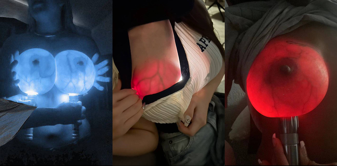 隆胸假体夜间发光！灯光照射奶子 乳房泛起诡异荧光 宛如科幻电影场景 令人瞠目结舌！ - 51吃瓜网-51吃瓜网