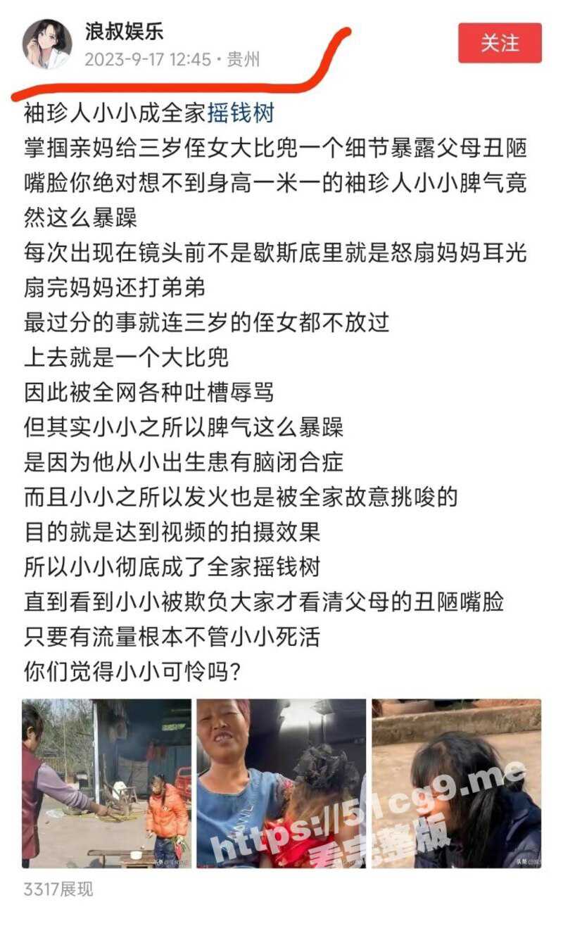 网红 袖珍女孩 脾气暴躁大反转 经遭亲妈残忍虐待挨毒打 全家人当她做摇钱树 早前曝光无人理 - 51吃瓜网-51吃瓜网
