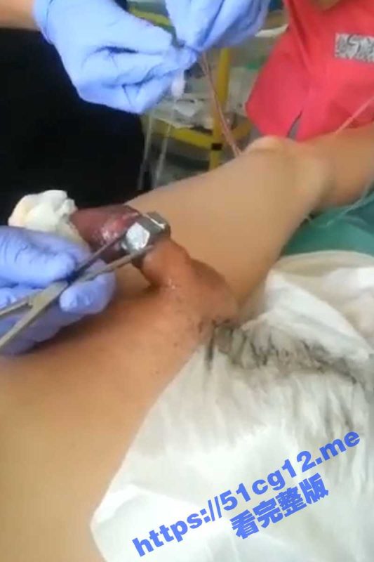 搞笑猎奇！把螺母套到鸡巴上取不下来 只能用电锯把螺丝据下来！-51吃瓜网