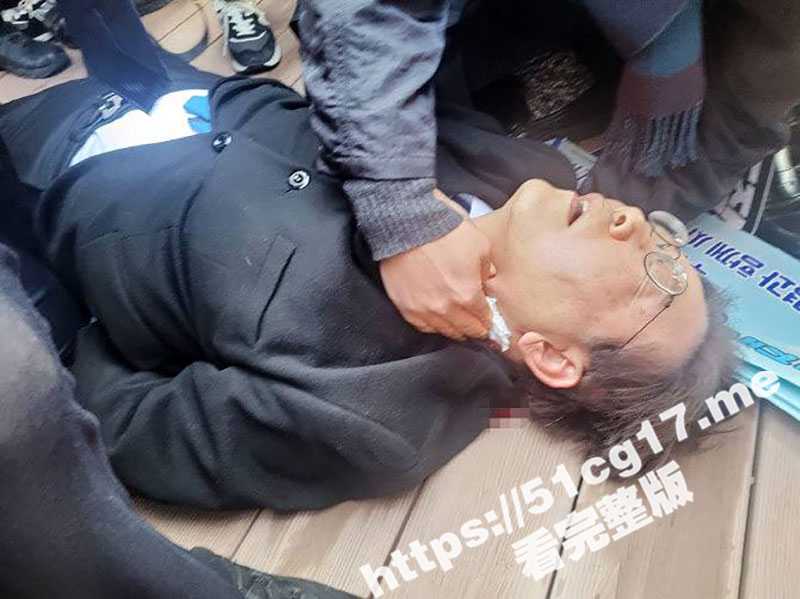 韩国最大在野党党首李在明出席活动时遇袭 遇袭视频曝光-51吃瓜网