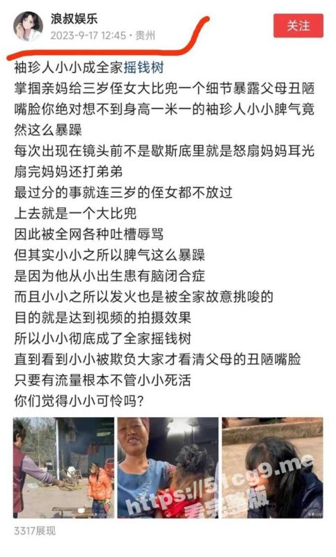 网红 袖珍女孩 脾气暴躁大反转 经遭亲妈残忍虐待挨毒打 全家人当她做摇钱树 早前曝光无人理-51吃瓜网