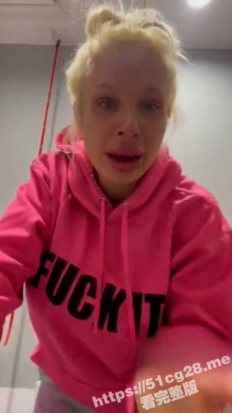 欧美 重口味视频 慎入 整容女隆胸后 填充物在胸部 直接炸了 现在只剩单只奶子了 - 51吃瓜网-51吃瓜网