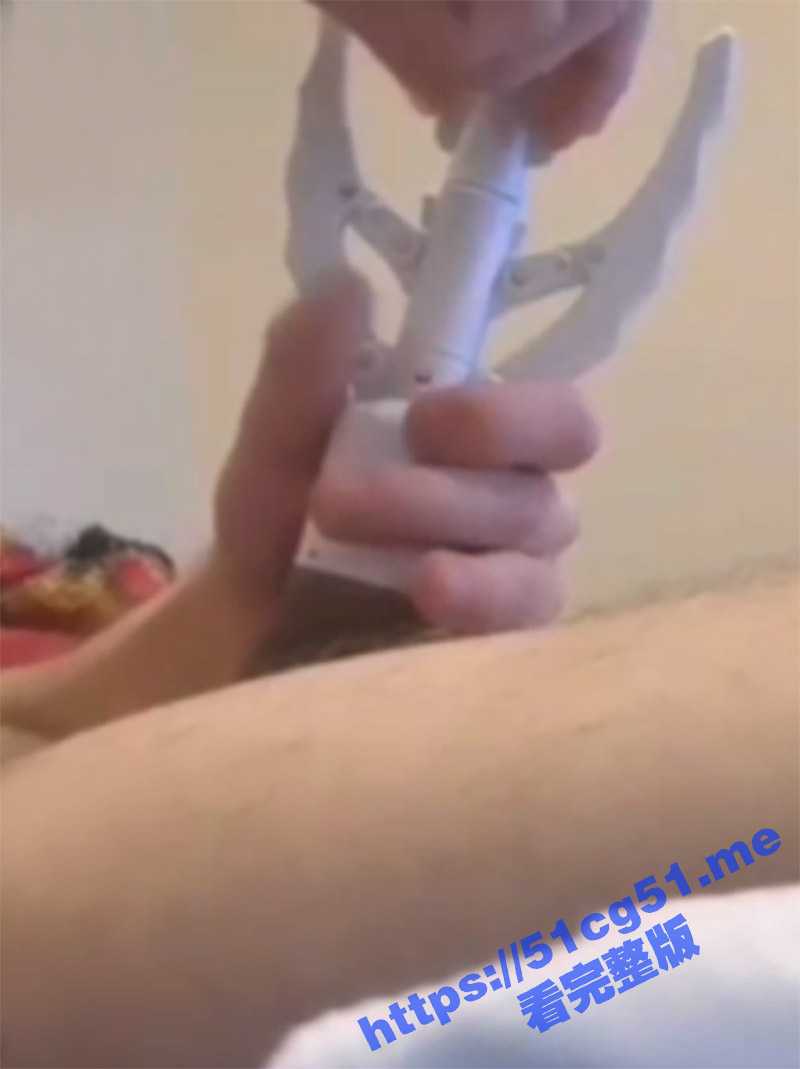 自己动手割包皮 外国人胆真大啊 这工具怎么看着像开瓶器啊 这么自己在家割真的安全么 - 51吃瓜网-51吃瓜网
