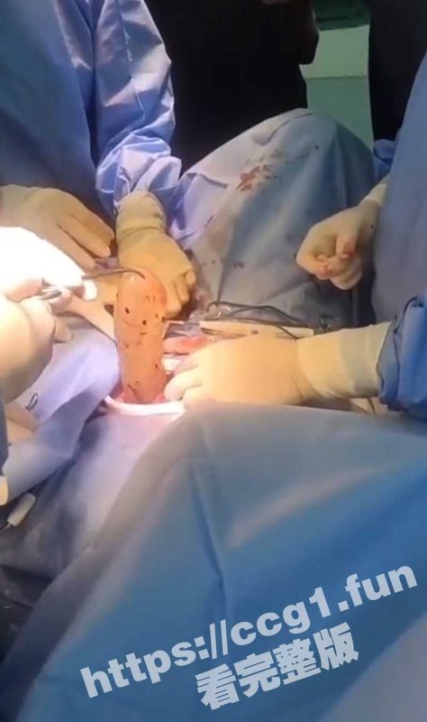 大型社死现场！美女自慰把超大的假屌塞入下体拿不出来 最后只能去医院动手术拿出来-51吃瓜网