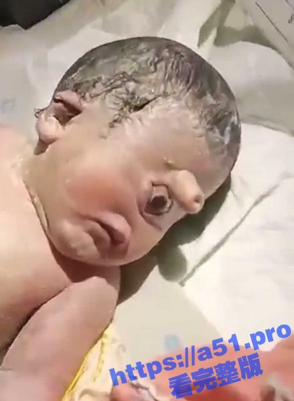 胆小慎入 印尼惊现独眼怪 新生儿小鸡鸡竟然长在头上 而且还只有一只眼 生前都不做产检的么-51吃瓜网