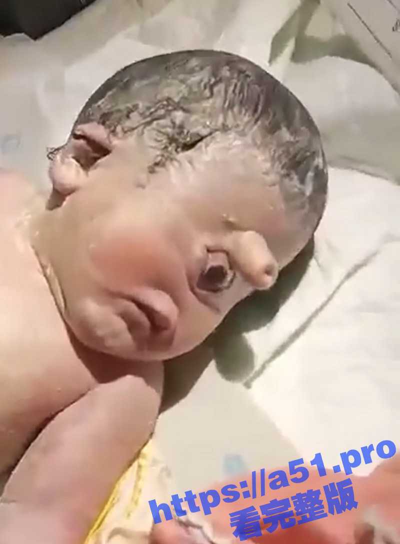 胆小慎入 印尼惊现独眼怪 新生儿小鸡鸡竟然长在头上 而且还只有一只眼 生前都不做产检的么 - 51吃瓜网-51吃瓜网