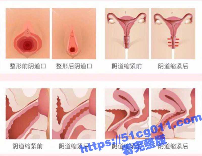 做紧致女人 让性福加倍!广州缩紧针火了 你的她为什么这么紧的原因来了!-51吃瓜网