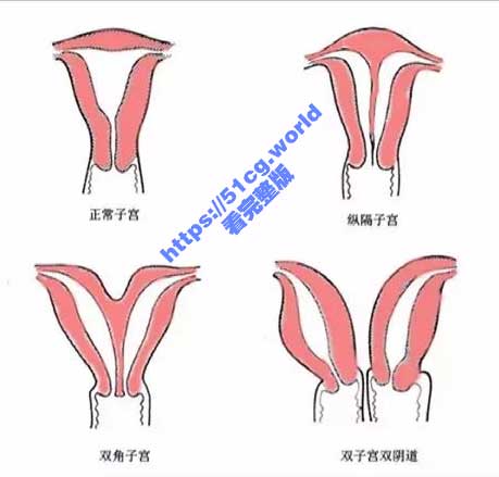 猎奇科普！一女子竟查出双阴道 还有两套生殖系统！一起来看看怎么事-51吃瓜网