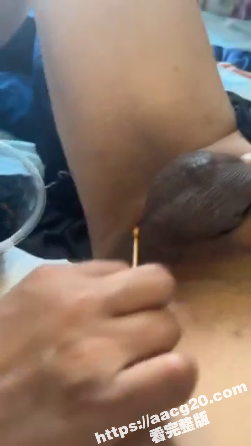 变性手术后真实画面 切屌变穴彻底成女人 连奶子都做出来了 消肿后还真是真假难辨啊 - 51吃瓜网-51吃瓜网