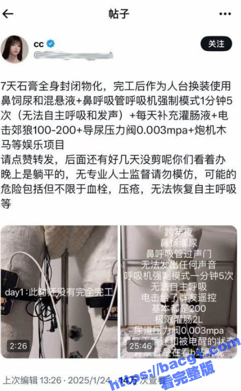 史上最炸裂猎奇佳作！7天石膏全身封闭物化 自动炮机24小时抽插不停 呼吸喂食全用管道！ - 51吃瓜网-51吃瓜网